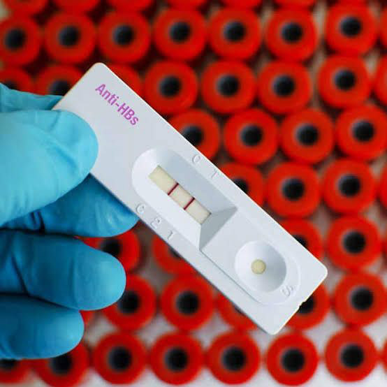 Piden a la ciudadanía prevenir contagios de hepatitis