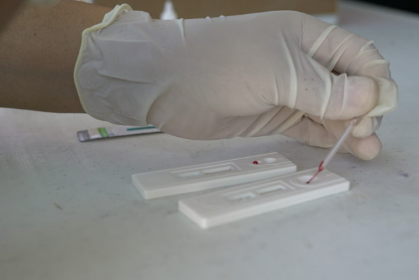 Detección y tratamiento gratuito a pacientes con hepatitis C