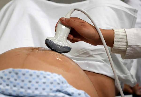 <em>Control prenatal, primordial en la prevención de la muerte materna</em>