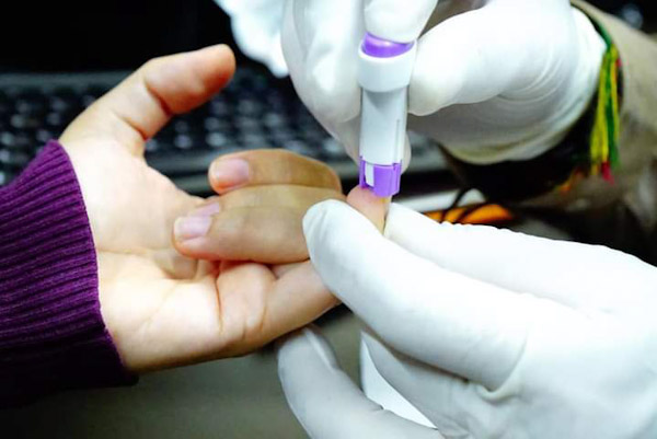 Aplica SSM pruebas gratuitas de hepatitis C