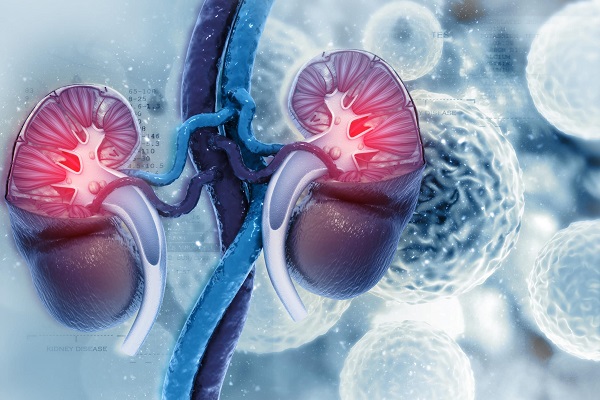 Conoce los síntomas del cáncer de riñón para detectarlo a tiempo