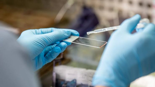 Importante que mujeres se realiceb pruebas de Papanicolaou y VPH