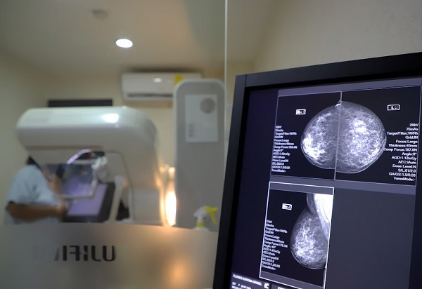 Más de 22 mil mastografías en 2024 en Michoacán